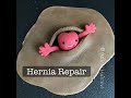 Playdough surgery  open inguinal hernia repair lichtenstein tensionfree mesh repair