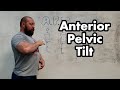 Anterior Pelvic Tilt and Bracing: How to Fix APT, Increase Bracing and Eliminate Low Back Pain