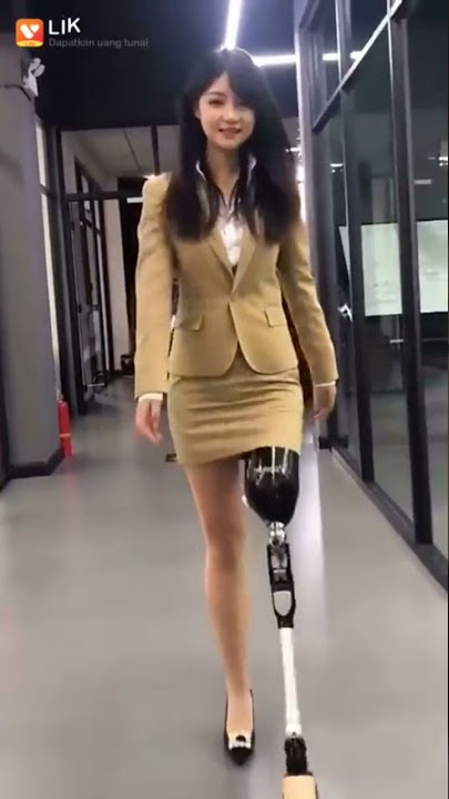 gimana rasanya punya kaki & bisa berjalan lagi 😍