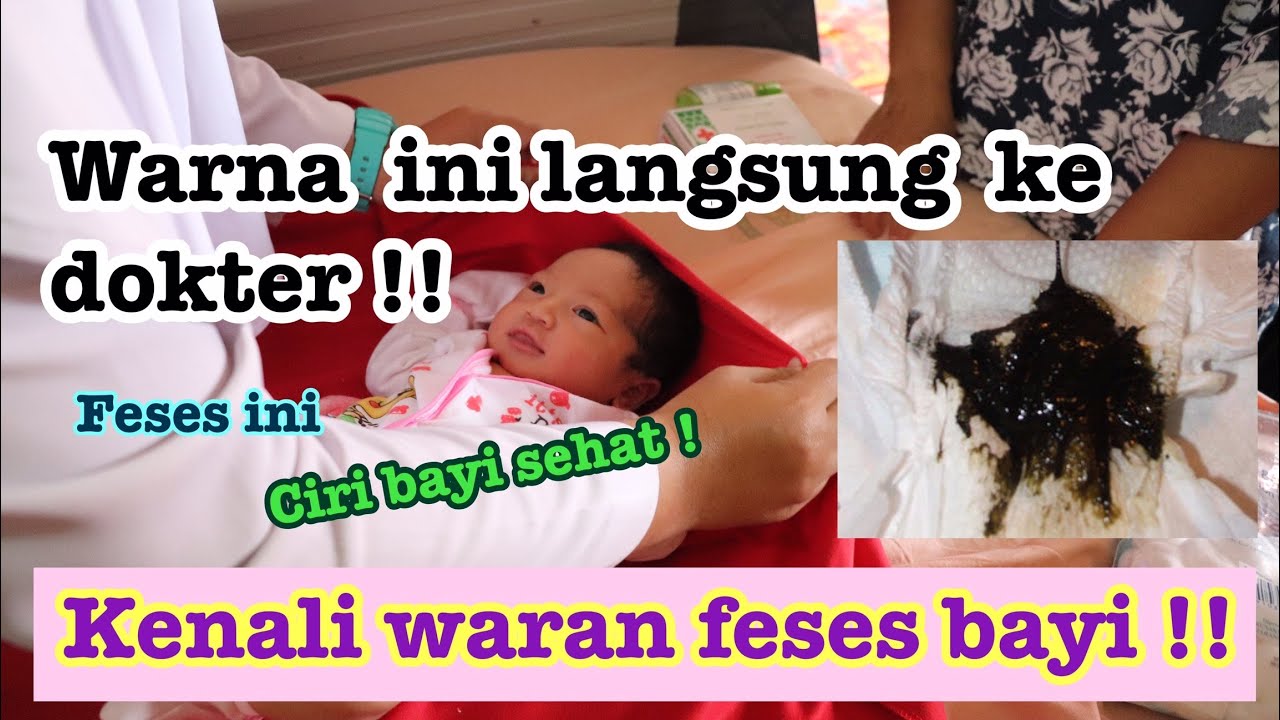 PENYEBAB WARNA FESES BAYI HITAM, HIJAU, KUNING, COKELAT. BUNDA WAJIB