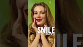 Full SMILE DESIGN Guide
