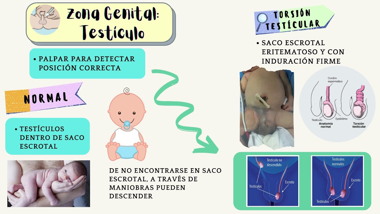 Cual es la mejor leche de formula para recien nacidos