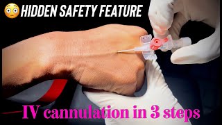 INTRAVENOUS CANNULATION IN 3 EASY STEPS