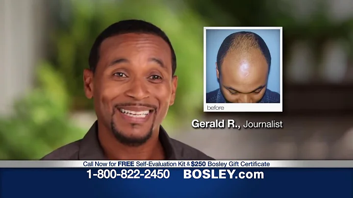 Bosley Commercial - "Your Hair" (2014)