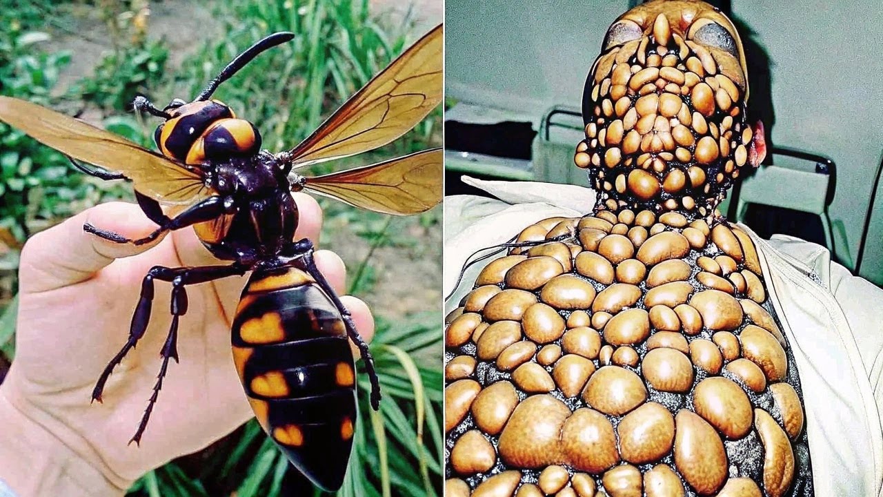 Here's What Happens After Being Bitten by Venomous Insects