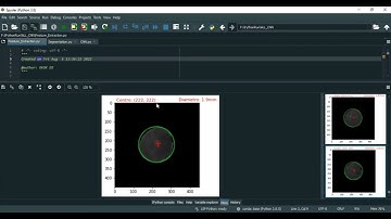 Retinal Vessel Segmentation Combined With Generative Adversarial Networks and Dense U Net