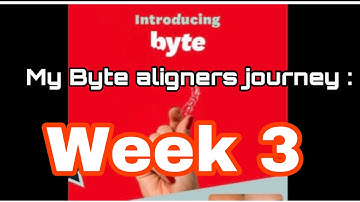 Byte aligners week 3