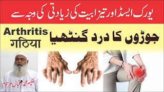 Arthritis || جوڑوں کا درد گنٹھیا  || जोड़ों का दर्द गठिया  || حکیم محمد اقبال  || Ubqari