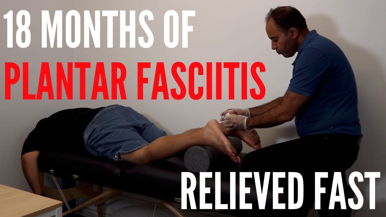 18 Months of Plantar Fasciitis RELIEVED (REAL RESULTS!!!) YouTube