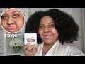 Cocoa butter for stretch marks and scars - YouTube