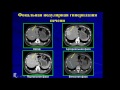 Лекция: «Многофазная компьютерная томография в оценке гепатобилиарной системы»