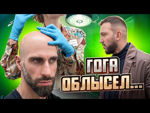 Has Goga Gone Completely Bald? Will a Hair Transplant Save Him?