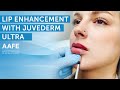 Adding More Lip Volume with Juvederm Ultra! | AAFE