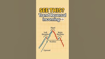 Head and Shoulders Pattern | Spot Reversals Like a Pro