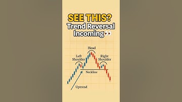 Head and Shoulders Pattern | Spot Reversals Like a Pro