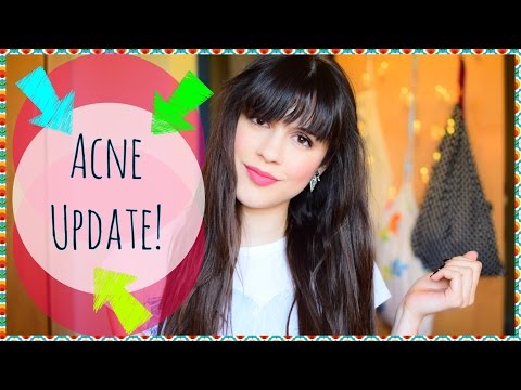 ⭐️  Acne Update! Finally Clear Skin! ⎥3 Months Belara Update ⭐️