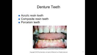 Ch 17 Polymers & Prosthetic Dentistry