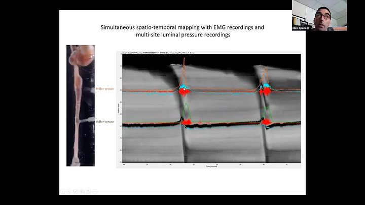 Spatio-temporal Imaging  In Real Time! With Profes...