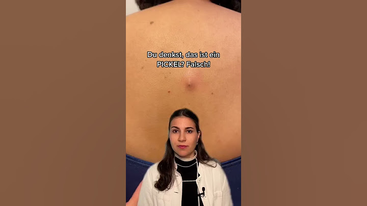 Das ist KEIN Pickel, sondern… 😨│Dr. med. Alice Martin #shorts