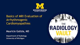 Mri Of Arrhythmogenic Cardiomyopathies