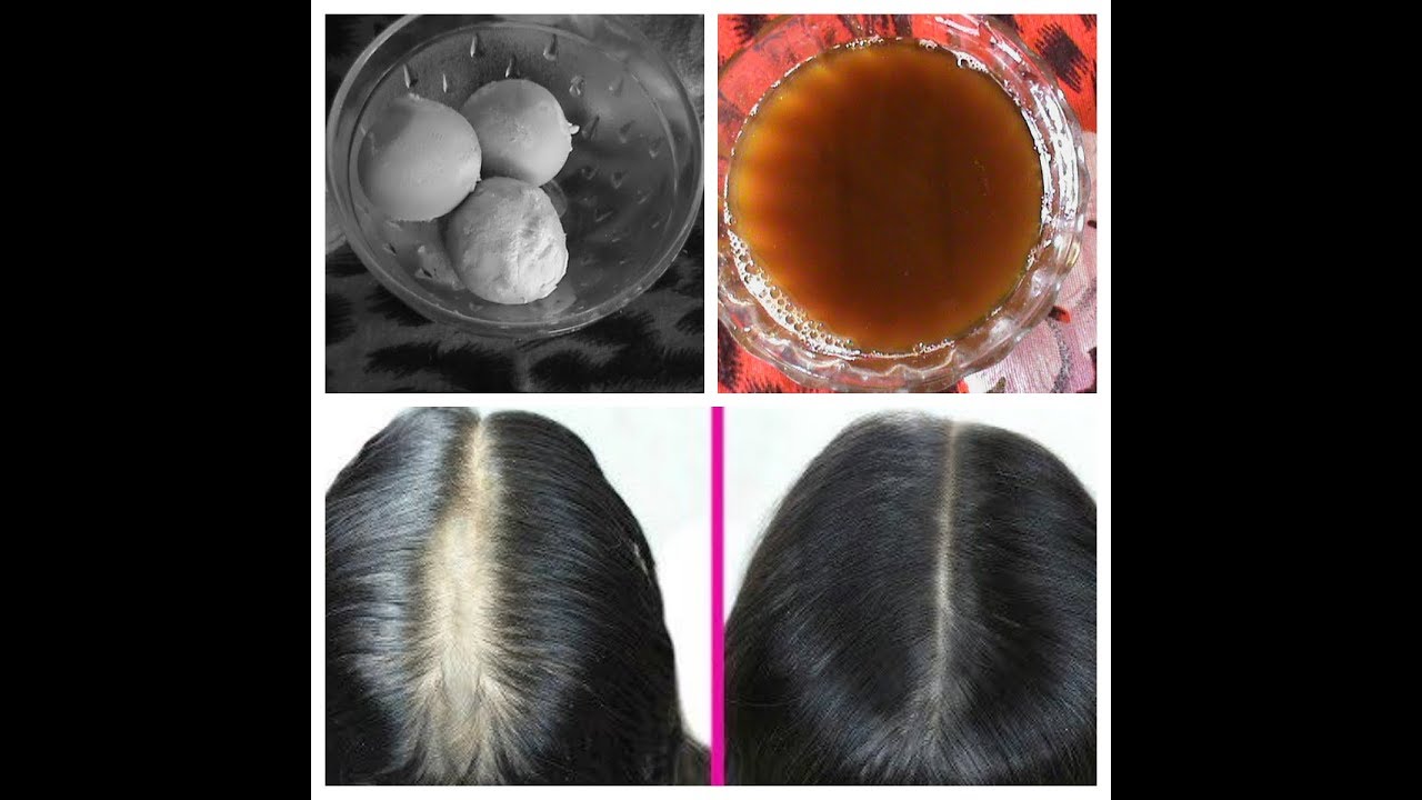 How To Make Protein Hair Growth Oil To Get Rid Of Baldness And To