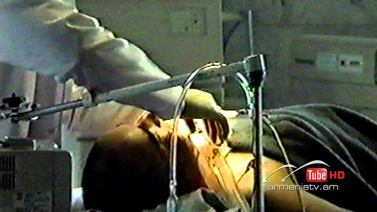 Սուր անկյուն. Հատուկ դեպքեր 06.04.2014 - Թողարկում 4 / Sur ankyun. Hatuk depqer