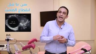 إيه هي طرق علاج أكياس المبيض؟