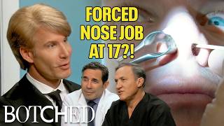 Robert's Mom FORCED Him To Get A Nose Job at 17 Years Old! | Rejected By Botched | E!