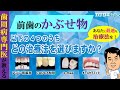 前歯の治療　おすすめの治療方法