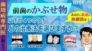 前歯の治療　おすすめの治療方法