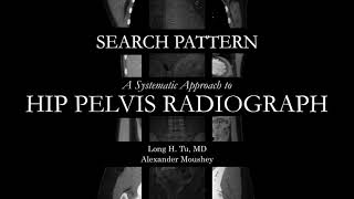 [XR] Hip Pelvis Radiograph | Search Pattern