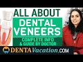 Complete Guide to Dental Veneers