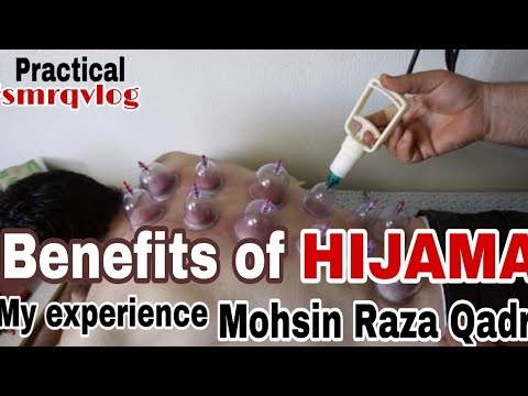 hijama