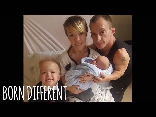 Malgre Le Nanisme Des Deux Parents Cette Famille Vient D Accueillir Son Deuxieme Enfant Felicitations Malgre Le Nanisme Des Deux Parents Cette Famille Vient D Accueillir Son Deuxieme Enfant Felicitations