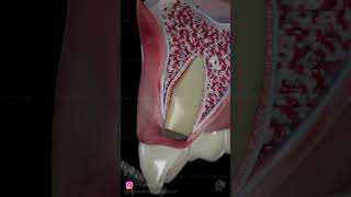 3D Dental animation - Socket shield Technique