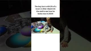 The boy born with 2% of a brain in 2012. Watch till the end to see how he looks now in 2024!