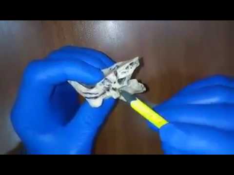 საფეთქლის ძვალი os temporale SDASU   Copy