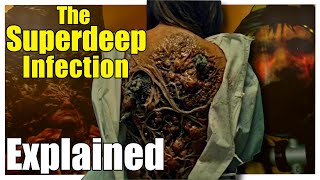 The SuperDeep FUNGAL INFECTION Explained | Why are we driven to dig really deep holes in the planet? screenshot 2