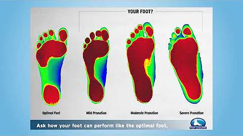 Breaking down the biomechanics of custom orthotics