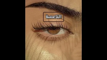 أنواع العيون 