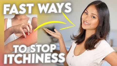 Stop Itchy Eczema (easy remedies!)