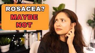 Redness on Cheek? It's Not Always Rosacea