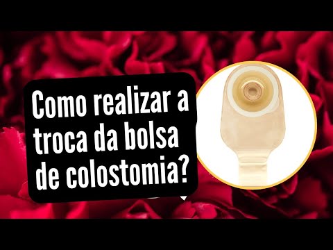 Vídeo: Com que frequência trocar a bolsa de ostomia?