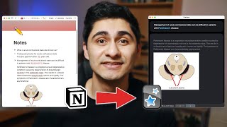 INSTANTLY Turn Your Notion Notes Into Anki Flashcards
