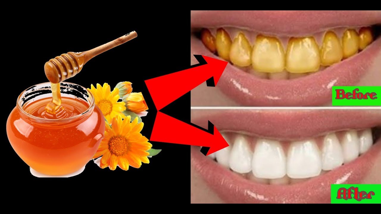 MAGICAL TEETH WHITENING REMEDY || NATURAL HOME REMEDY - YouTube