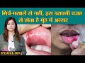 Mouth Ulcer यानी मुंह में छाले क्यों हो जाते हैं, कैसे ठीक करें जानें Doctors से | Sehat ep 309