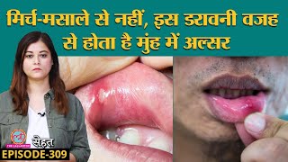Mouth Ulcer यानी मुंह में छाले क्यों हो जाते हैं, कैसे ठीक करें जानें Doctors से | Sehat ep 309