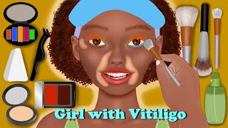 Black Beauty with Vitiligo Makeup Animation | Makeup Animation | ONDONG