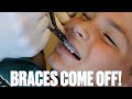 GETTING BRACES OFF FOR THE FIRST TIME | BRACES REMOVED | TAKING BRACES OFF | BEFORE AND AFTER BRACES