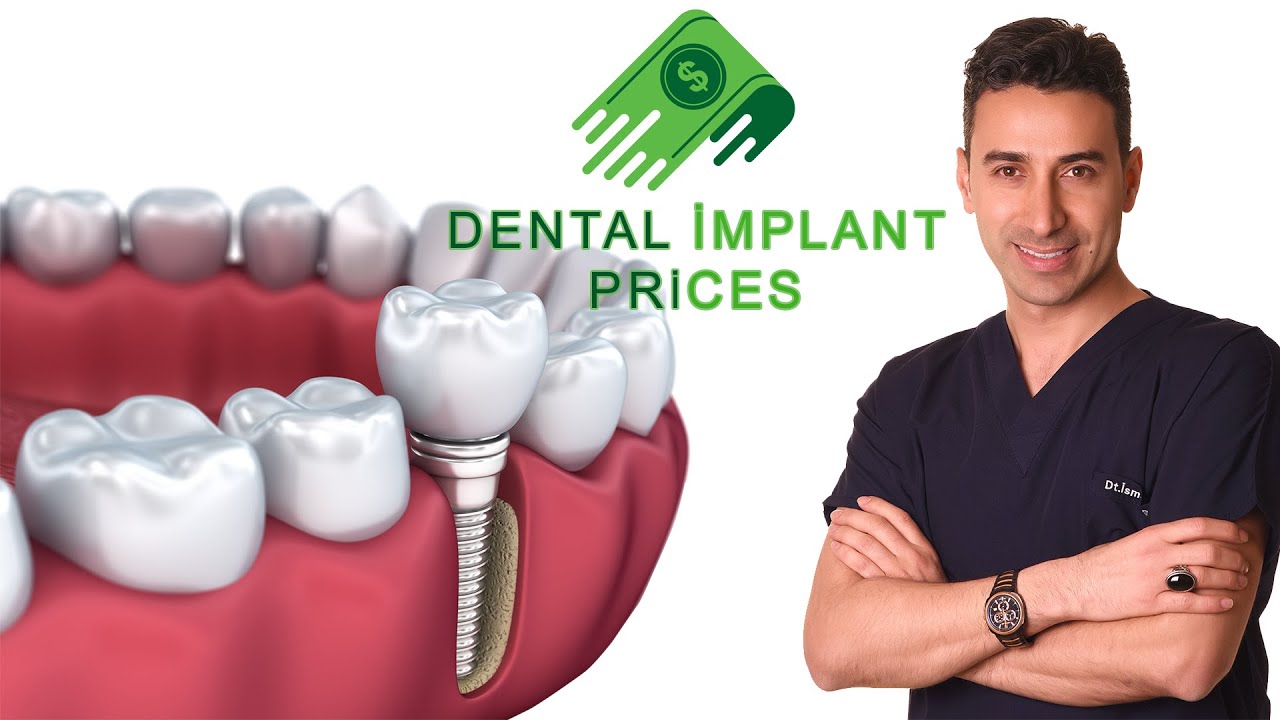 أسعار زراعة الأسنان 2020 اسطنبول تركيا | Dental implant prices turkey